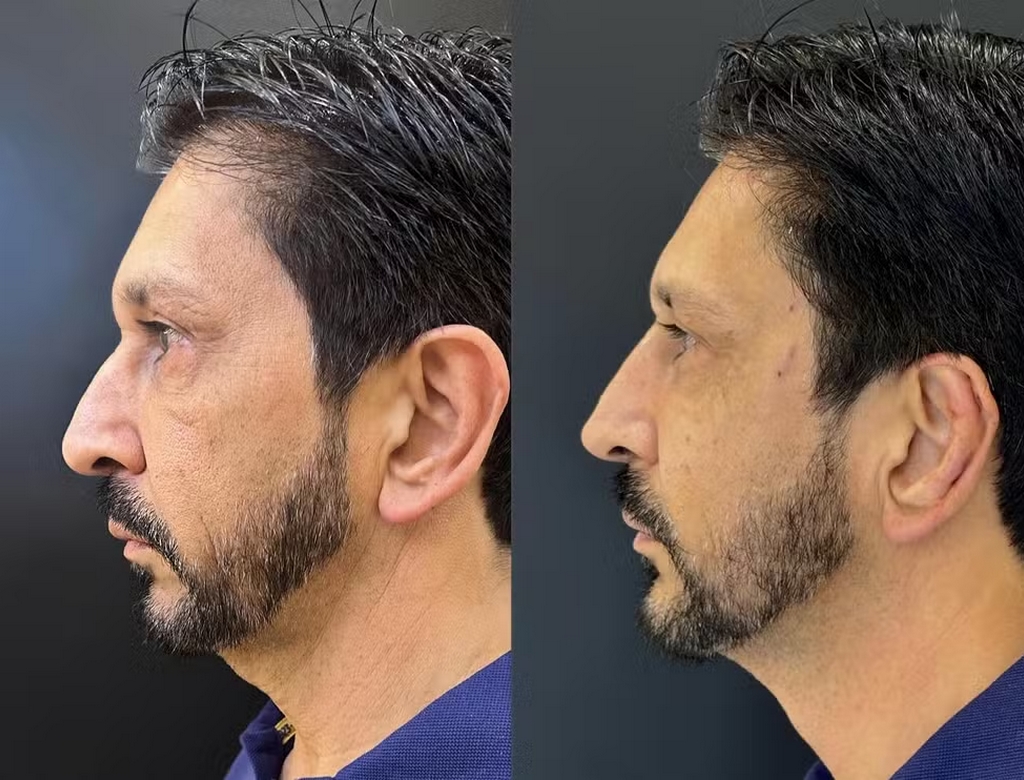 Prefeito De Sp (foto Reprodução Redes Sociais) 1