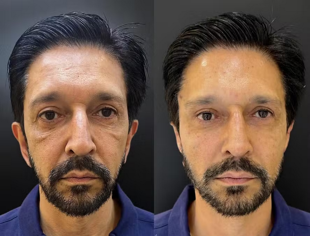 Prefeito De Sp (foto Reprodução Redes Sociais)