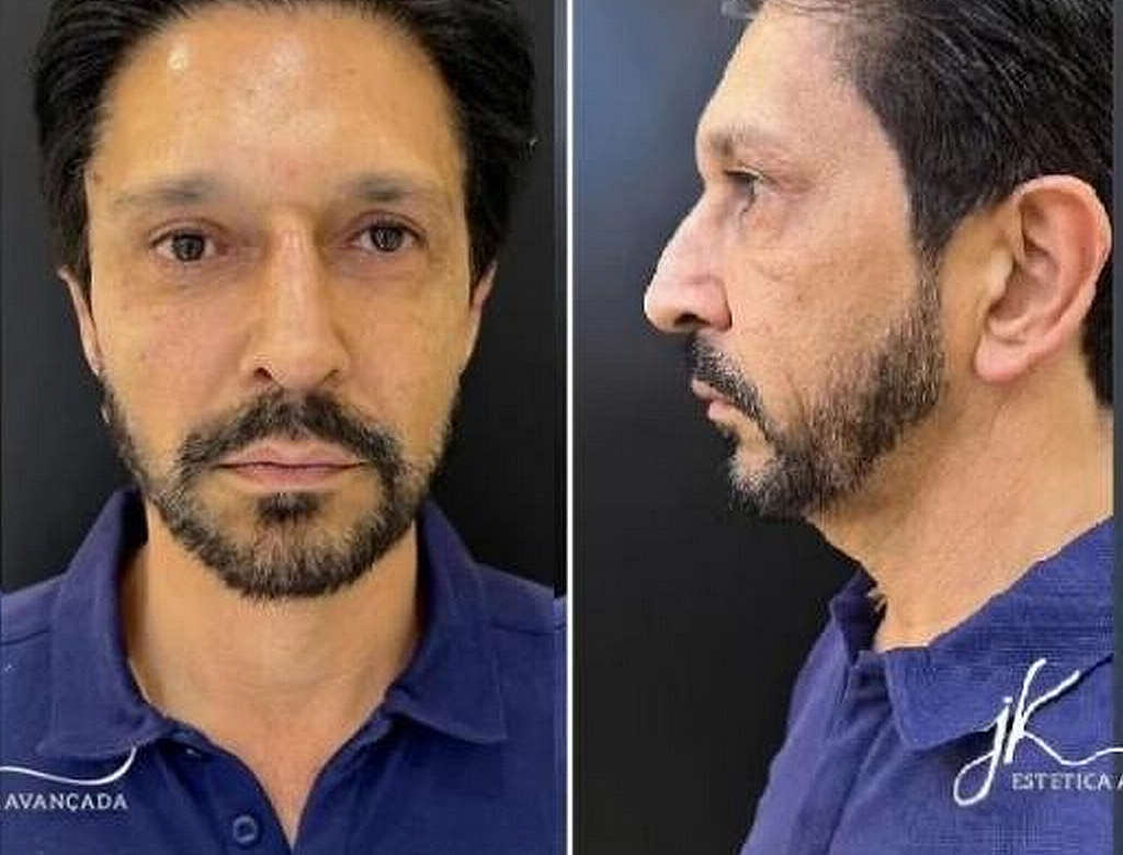 Prefeito De Sp (foto Reprodução Redes Sociais) 2