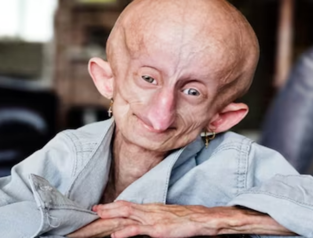 Beandri Booysen (foto Reprodução Redes Sociais)