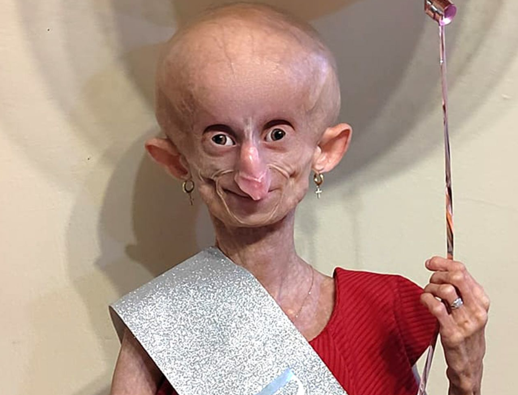 Beandri Booysen (Foto Reprodução Redes Sociais)