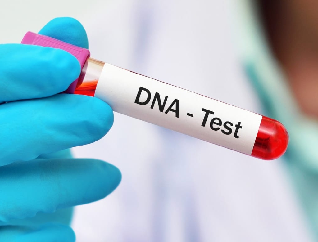 Teste De Dna (foto Reprodução Redes Sociais) 1
