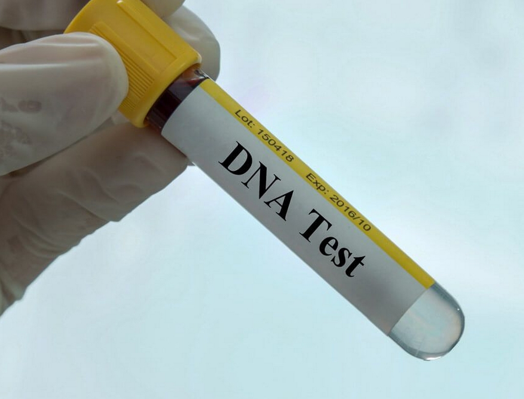 Teste De Dna (foto Reprodução Redes Sociais)