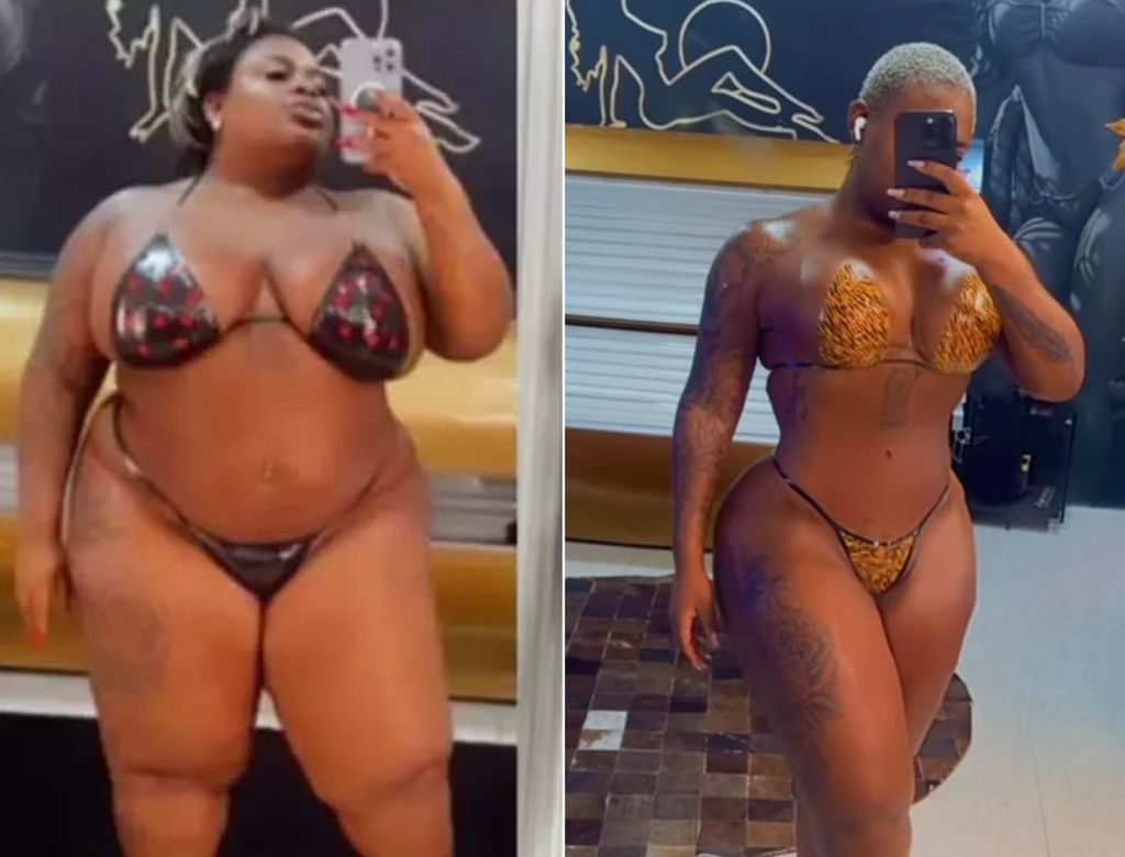 Antes E Depois De Jojo Todynho(1)