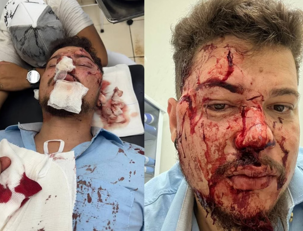 Cantor sertanejo fica com rosto desfigurado após ser agredido (Foto Reprodução Redes Sociais)
