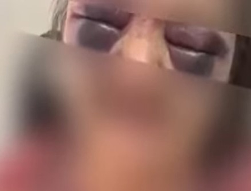 Idosa (foto Reprodução Redes Sociais)