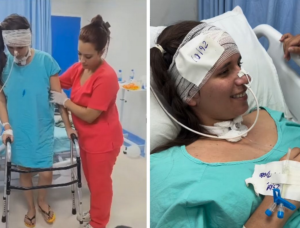 Jovem Baleada (foto Reprodução Redes Sociais)