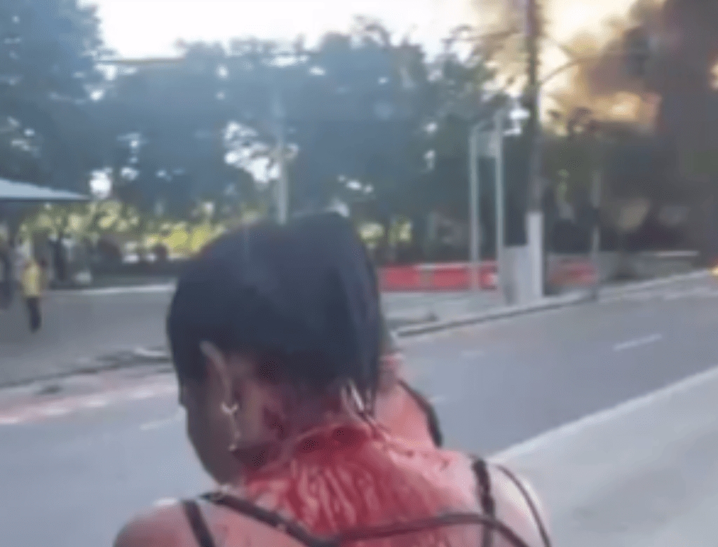 Acidente (foto Reprodução Redes Sociais)