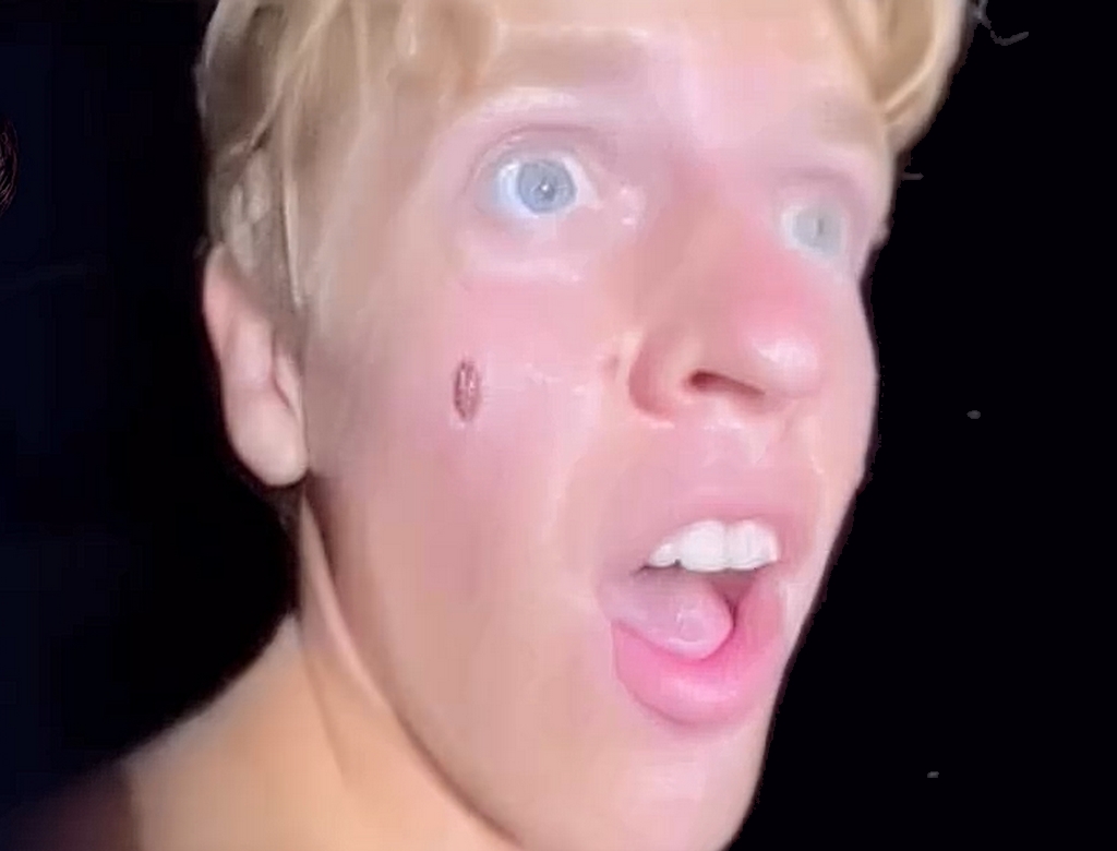 Ataque De Tubarão (foto Reprodução Redes Sociais)