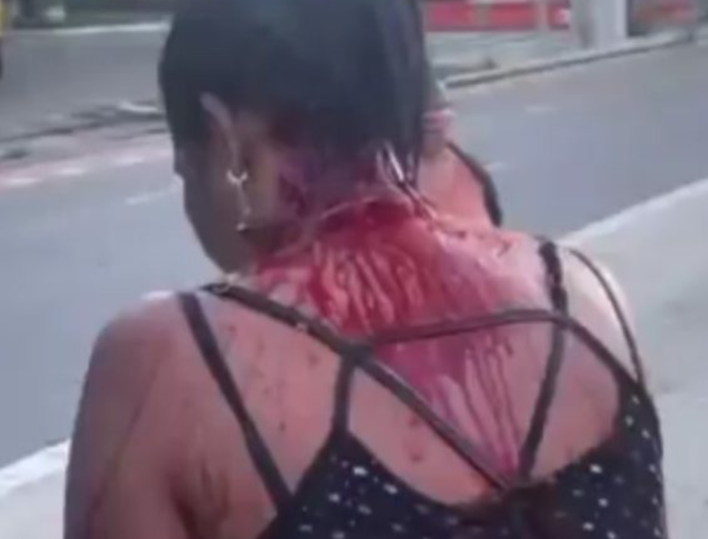 Mulher Fica Ensanguentada E Desorientada Após Queda De Avião (foto Reprodução Redes Sociais)
