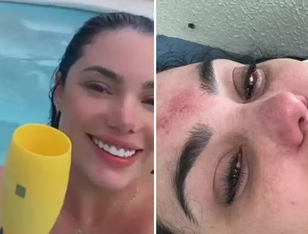 Acidente (foto Reprodução Redes Sociais) 5