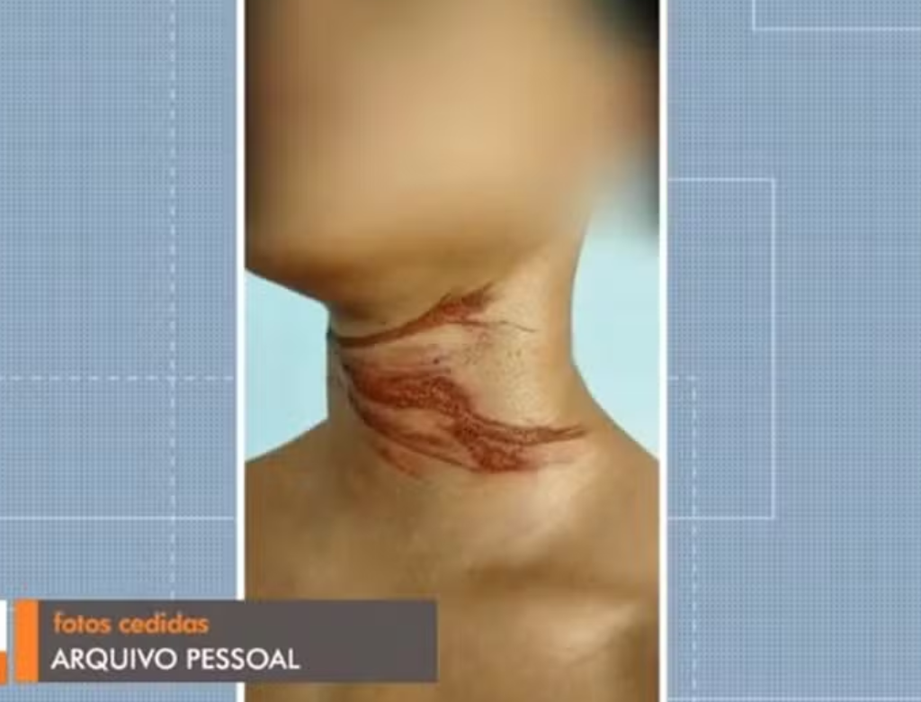 Ciclista de 16 anos fica ferido ao enroscar pescoço em fio solto (Foto Reprodução Redes Sociais)