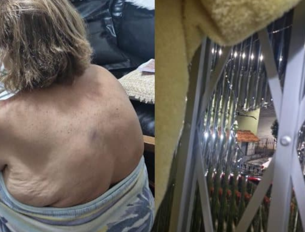 Professora de 65 anos é agredida por familiares de aluno (Foto Reprodução Redes Sociais)