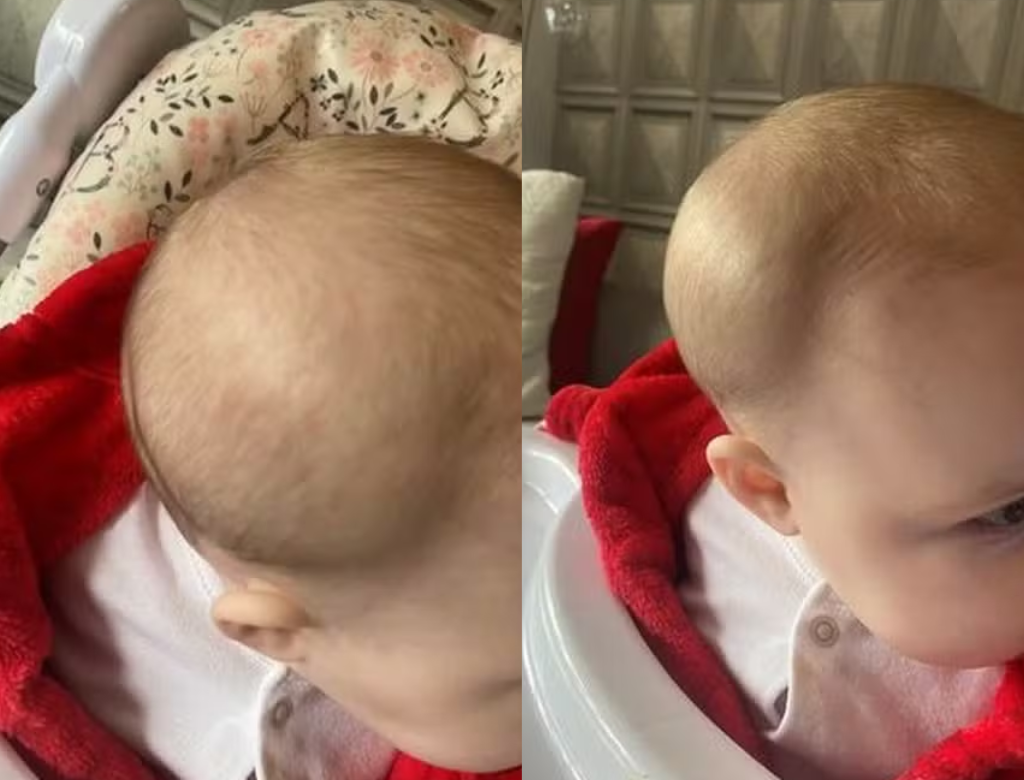 Mãe Encontra Fratura No Crânio Da Filha Ao Buscá La Na Creche (foto Reprodução Redes Sociais)