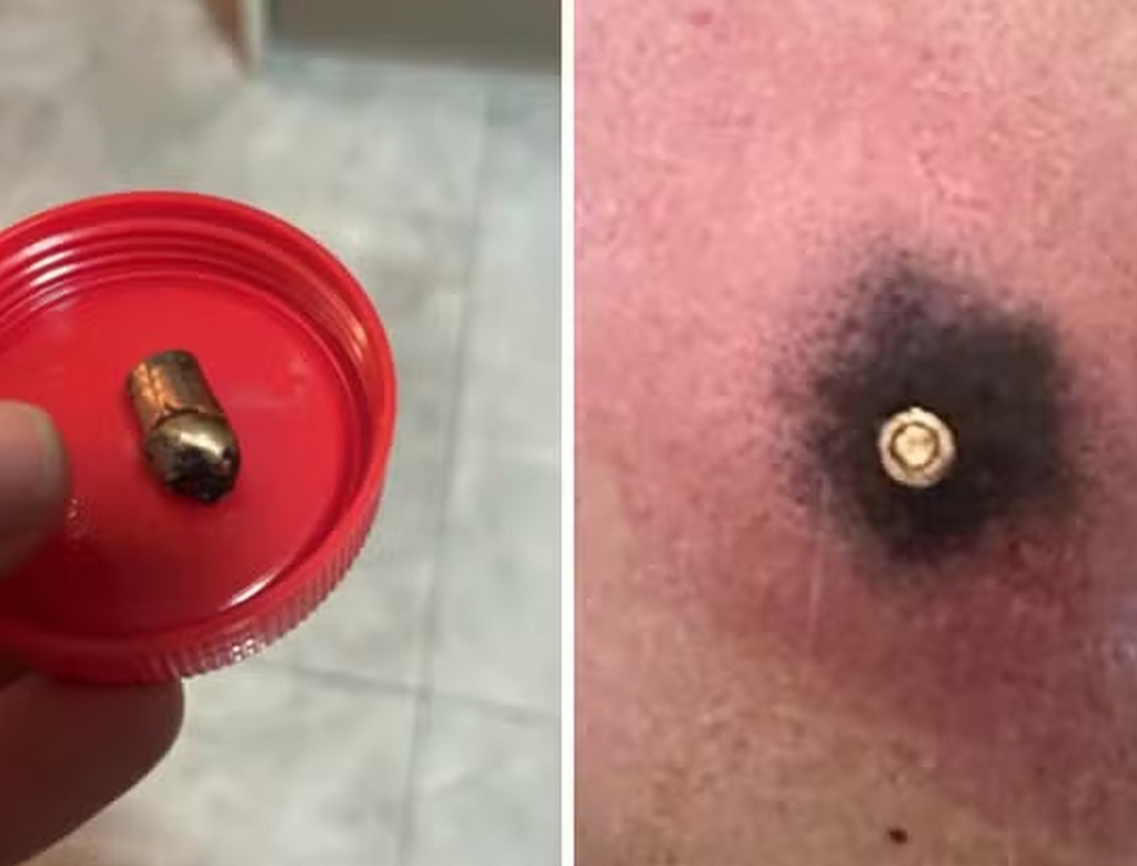 Tiro (foto Reprodução Redes Sociais) 2