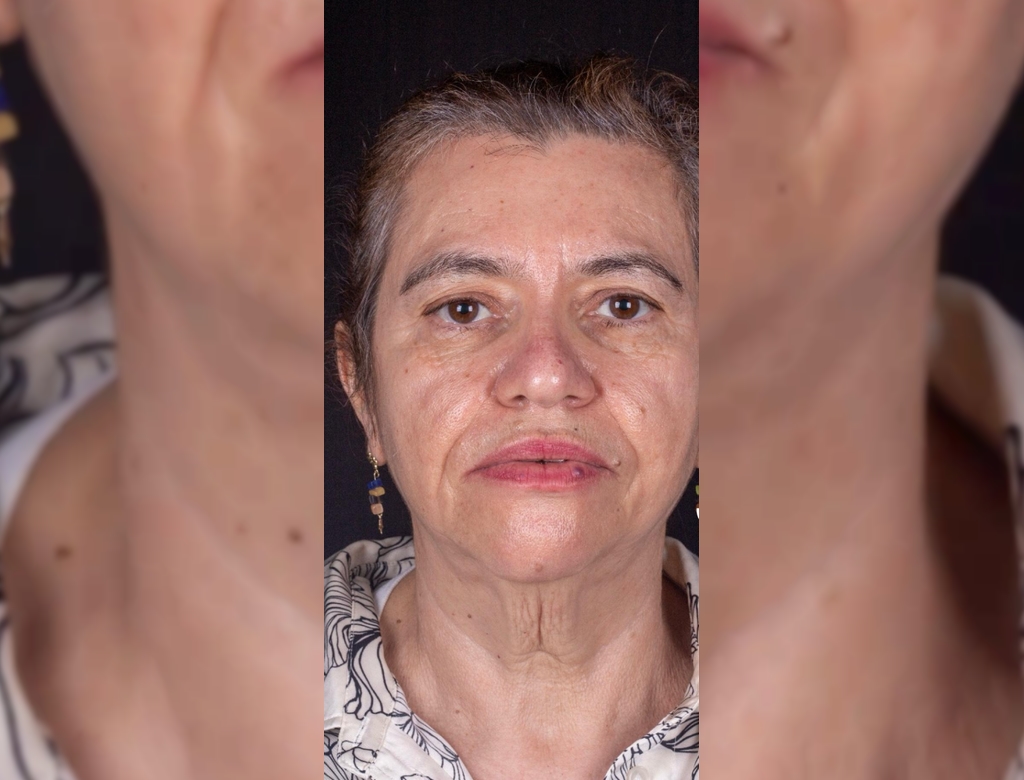 Antes E Depois (foto Reprodução Redes Sociais) 1
