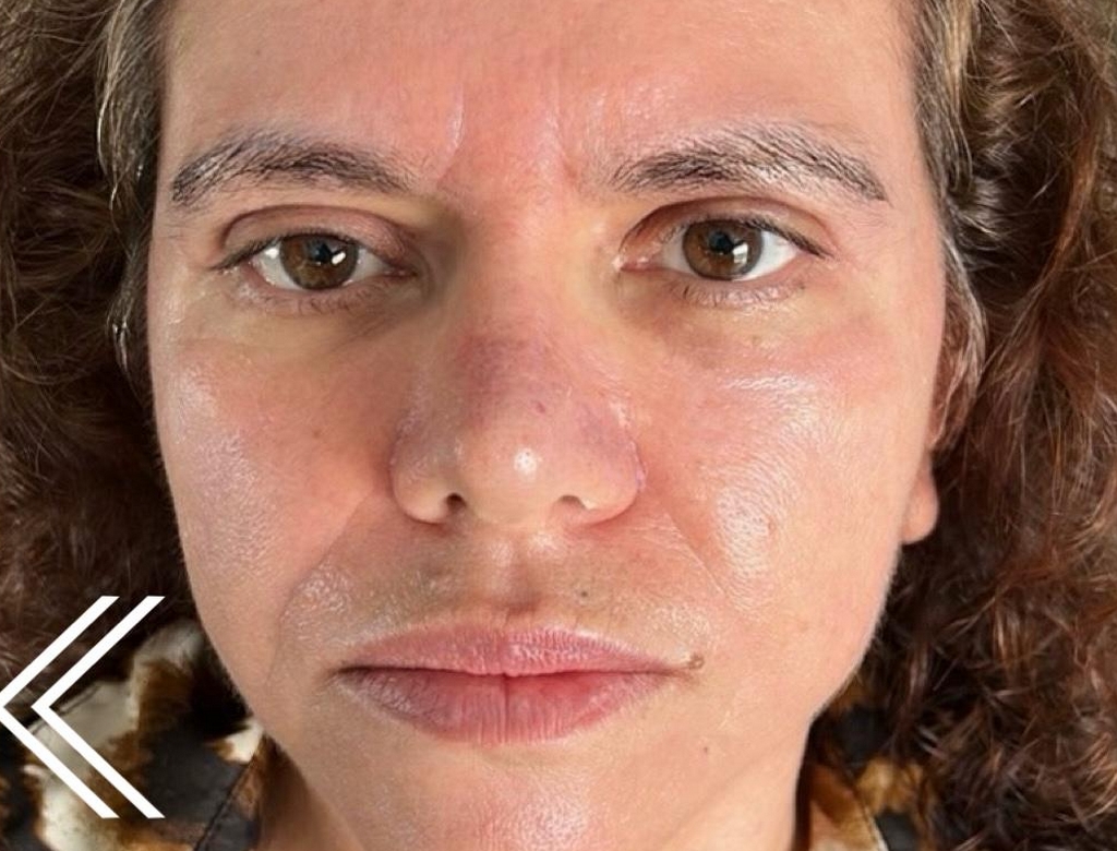 Antes E Depois (foto Reprodução Redes Sociais) 2