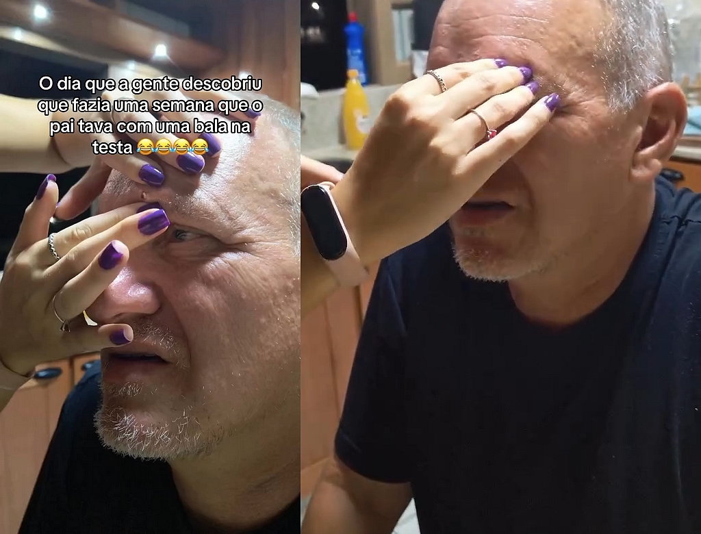 Bala (foto Reprodução Redes Sociais)