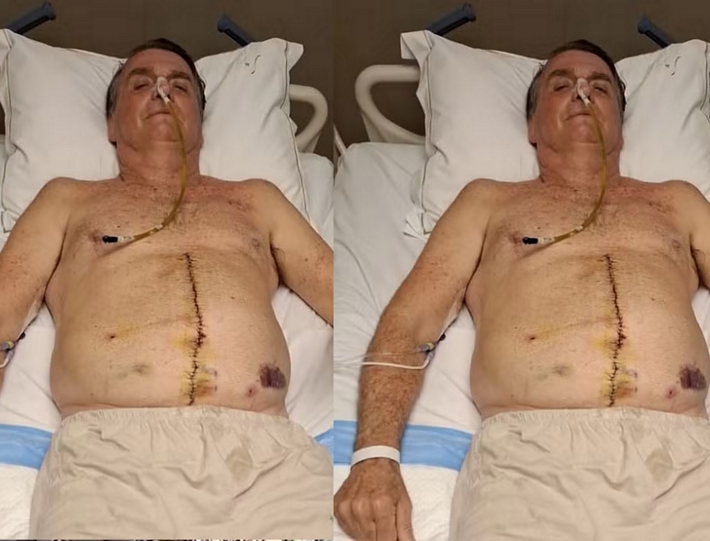 Bolsonaro (foto Reprodução Redes Sociais)