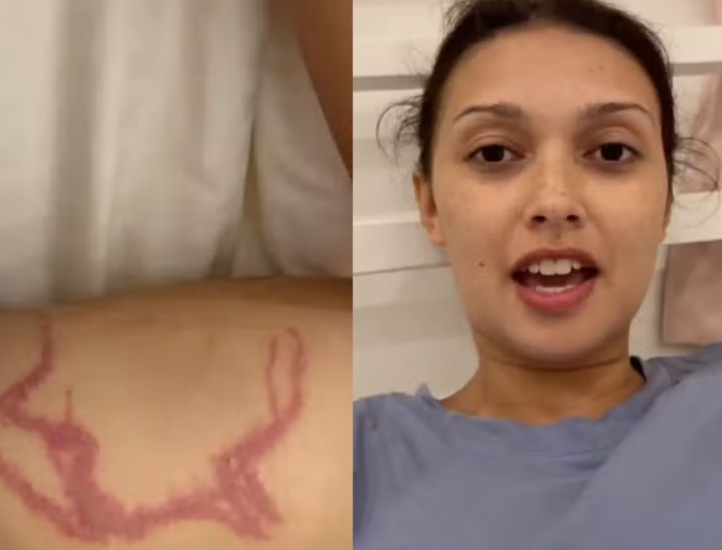 Influencer é picada por uma das criaturas mais venenosas do mundo (Foto Reprodução Redes Sociais)