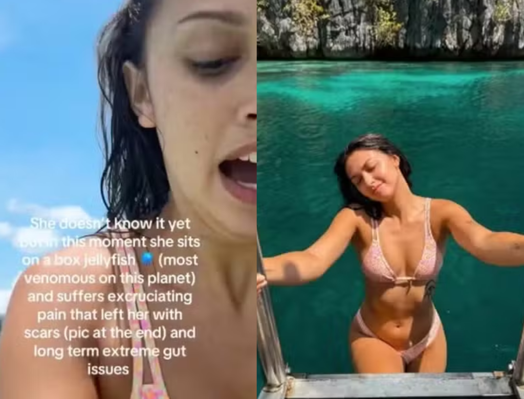 Influencer é Picada Por Uma Das Criaturas Mais Venenosas Do Mundo (foto Reprodução Redes Sociais)