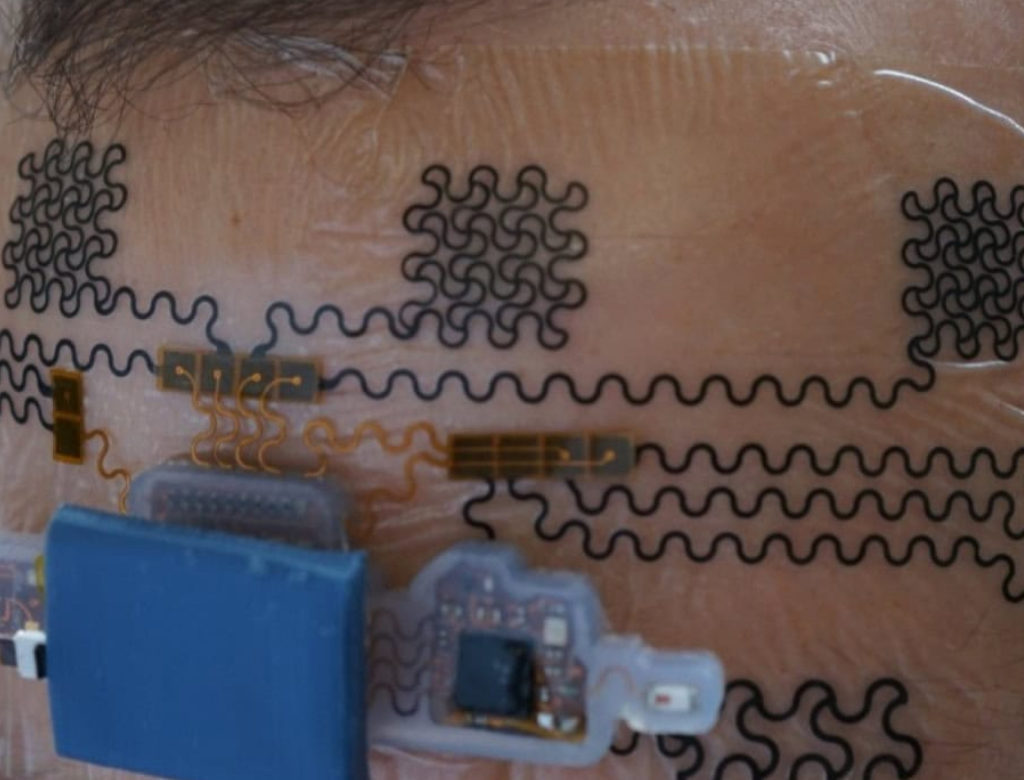 Nova Tatuagem Pode 'ler' Mente E Detectar Estado De Saúde Mental (foto Reprodução Redes Sociais)