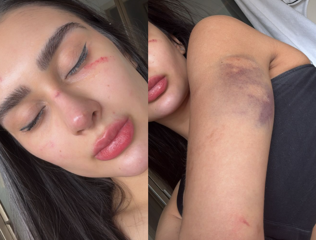 Miss Grand Amazonas denuncia ex por agressões e diz viver com medo (Foto Reprodução Redes Sociais)