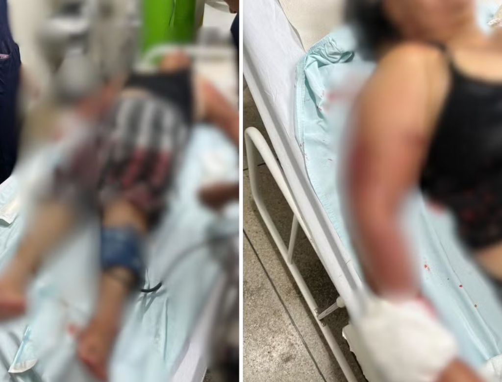 Avó enfrenta ataque de pitbull para salvar neta e leva mais de 60 pontos (Foto Reprodução Redes Sociais)