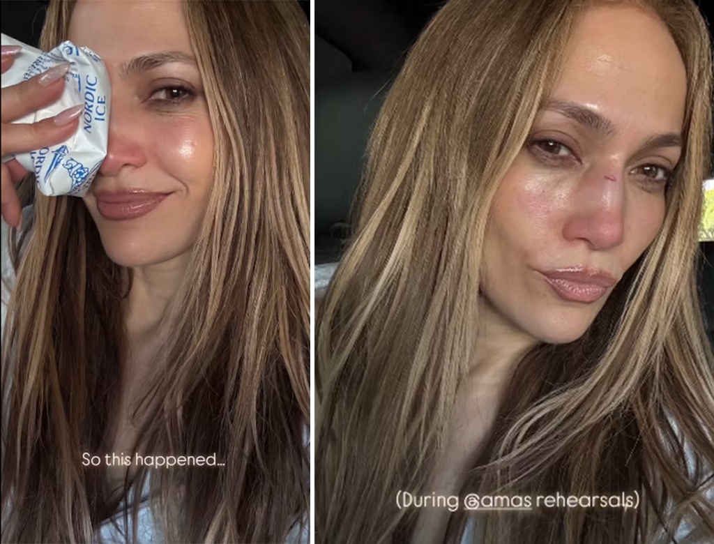 J Lo (foto Reprodução Redes Sociais) 1
