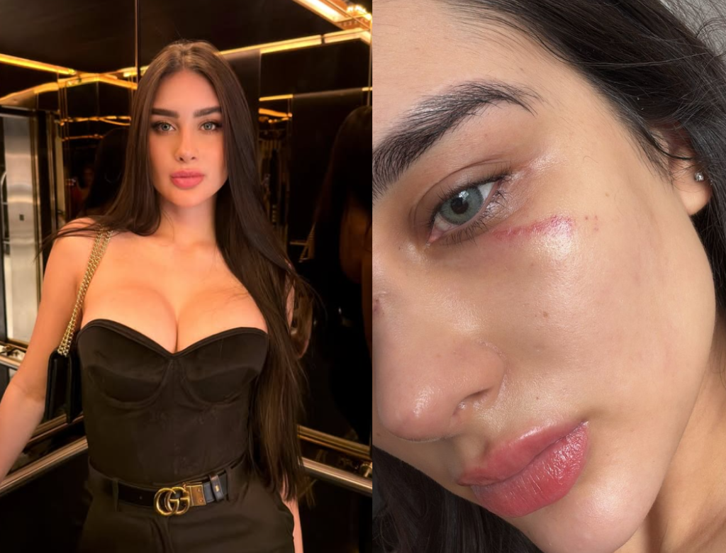Miss Grand Amazonas Denuncia Ex Por Agressões E Diz Viver Com Medo (foto Reprodução Redes Sociais)