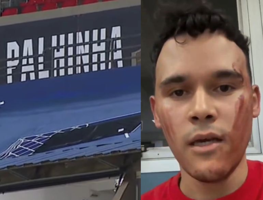 Placa De Metal Despenca Durante Jogo Do São Paulo E Deixa Feridos (foto Reprodução Redes Sociais)