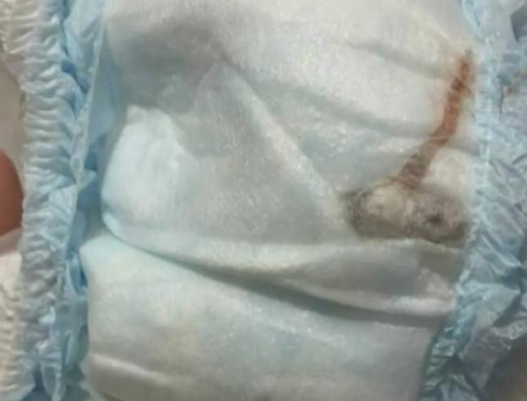 Mãe encontra rato morto dentro da fralda do filho  (Foto Reprodução Redes Sociais)