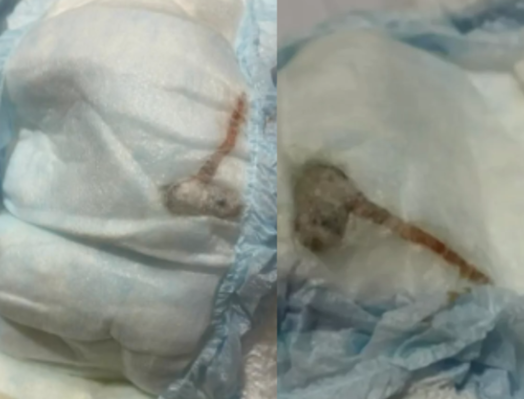 Mãe Encontra Rato Morto Dentro Da Fralda Do Filho (foto Reprodução Redes Sociais)